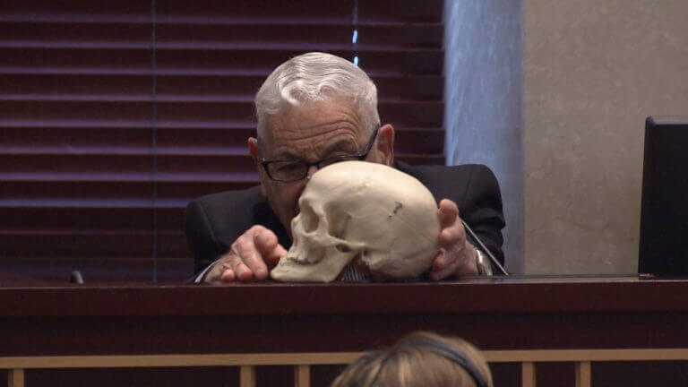 72-FL v. Anthony: Dr. Werner Spitz
