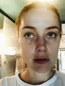 Amber Heard denies fabricating injuries in Depp libel trial