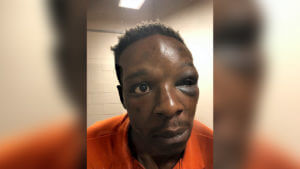 Sheriff: Deputy on video punching Black man in Georgia fired