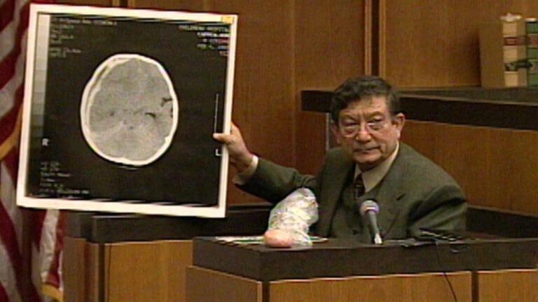 52-MA v. Woodward: Dr. Ayub Ommaya