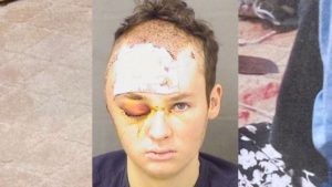 Deputy shoots knife-wielding suspect during alleged hostage situation