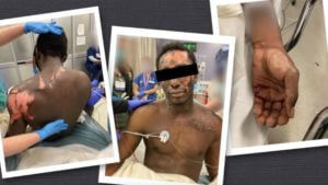 Man burned and stabbed in Baltimore jail files billion-dollar lawsuit