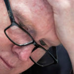 Alex Murdaugh cries as injuries family suffered are described.