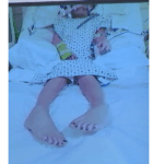 Maya Kowalski's feet are seen in a photo