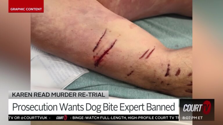 Prosecution in Karen Read's Retrial Want Dog Bite Expert Banned