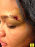 cassie ventura showing injuries