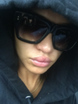 selfie of cassie ventura showing injuries