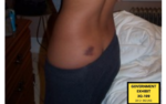 Cassie Ventura is seen with a bruise on her back