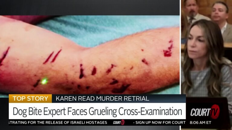 Did a Dog Bite or Scratch John O'Keefe?