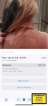 bryana bongolan's injuries