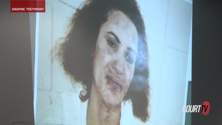 Lucy Medina's Bloody Face, Hands Shown to Jury
