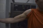 kohberger's arm