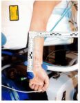 A photo shows injuries to Lindsay Clancy's arm. (court exhibit)
