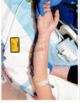 A photo shows injuries to Lindsay Clancy's arm. (court exhibit)